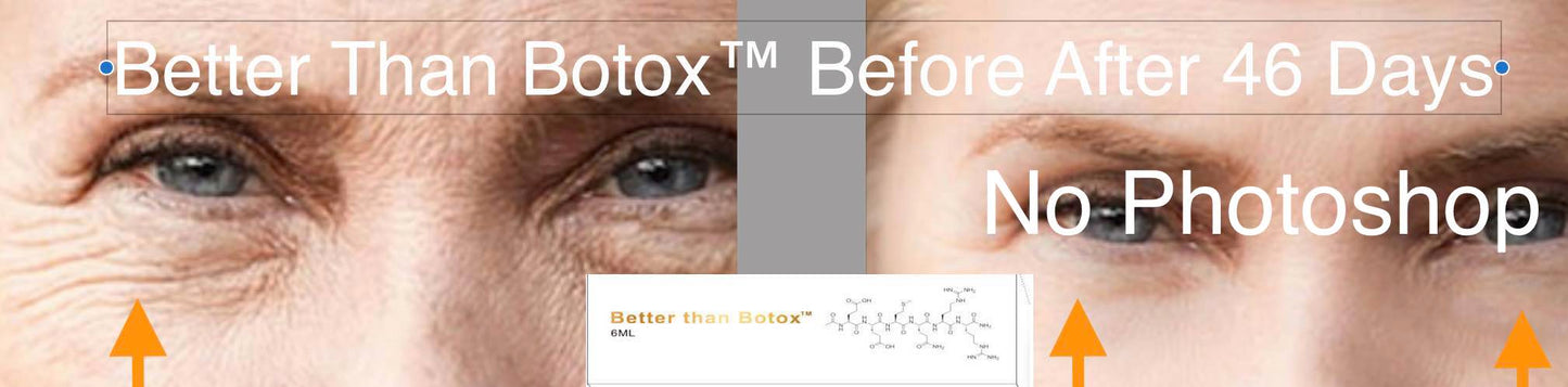 
                  
                    Mejor que Botox™ Arrugas debajo de los ojos
                  
                