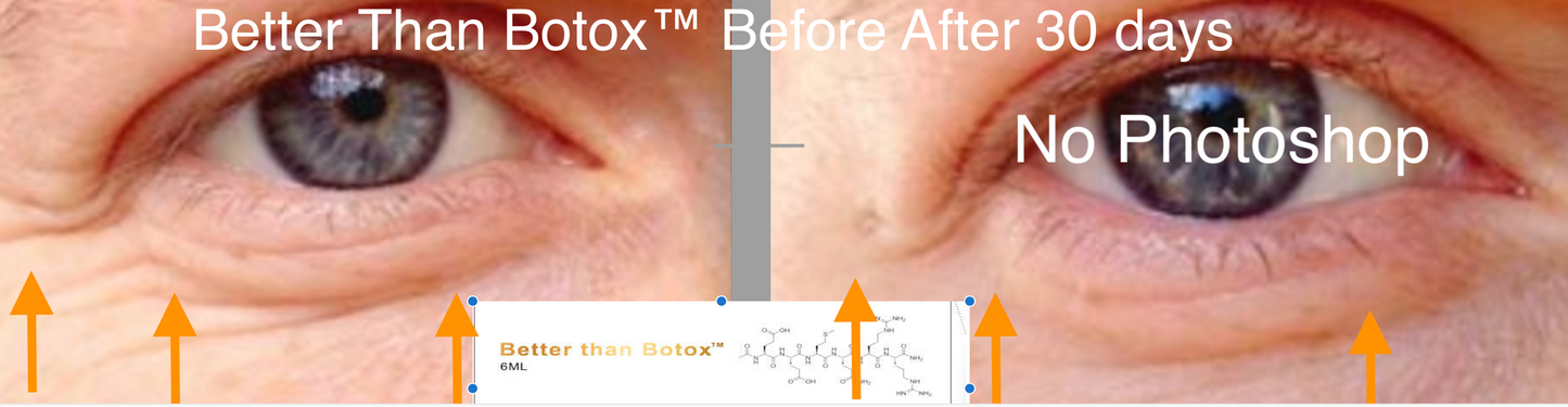 
                  
                    Quantum Facial "Professional Edition Under Eye Wrinkles
                  
                